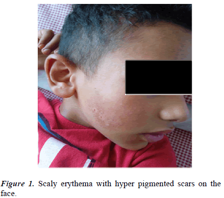 Current-Pediatrics-pigmented